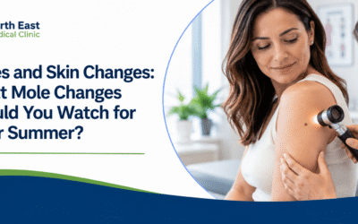 Mole Changes After Summer: What Should You Watch For?